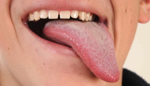 Lingua